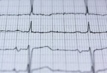 revenue analysis for stellar